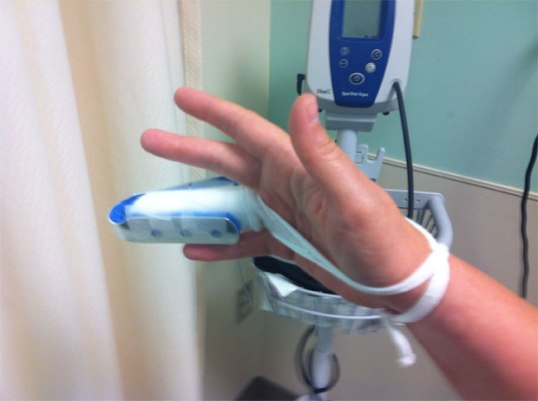 Katie's finger, a mandoline victim, bandaged at the Emergency Room.